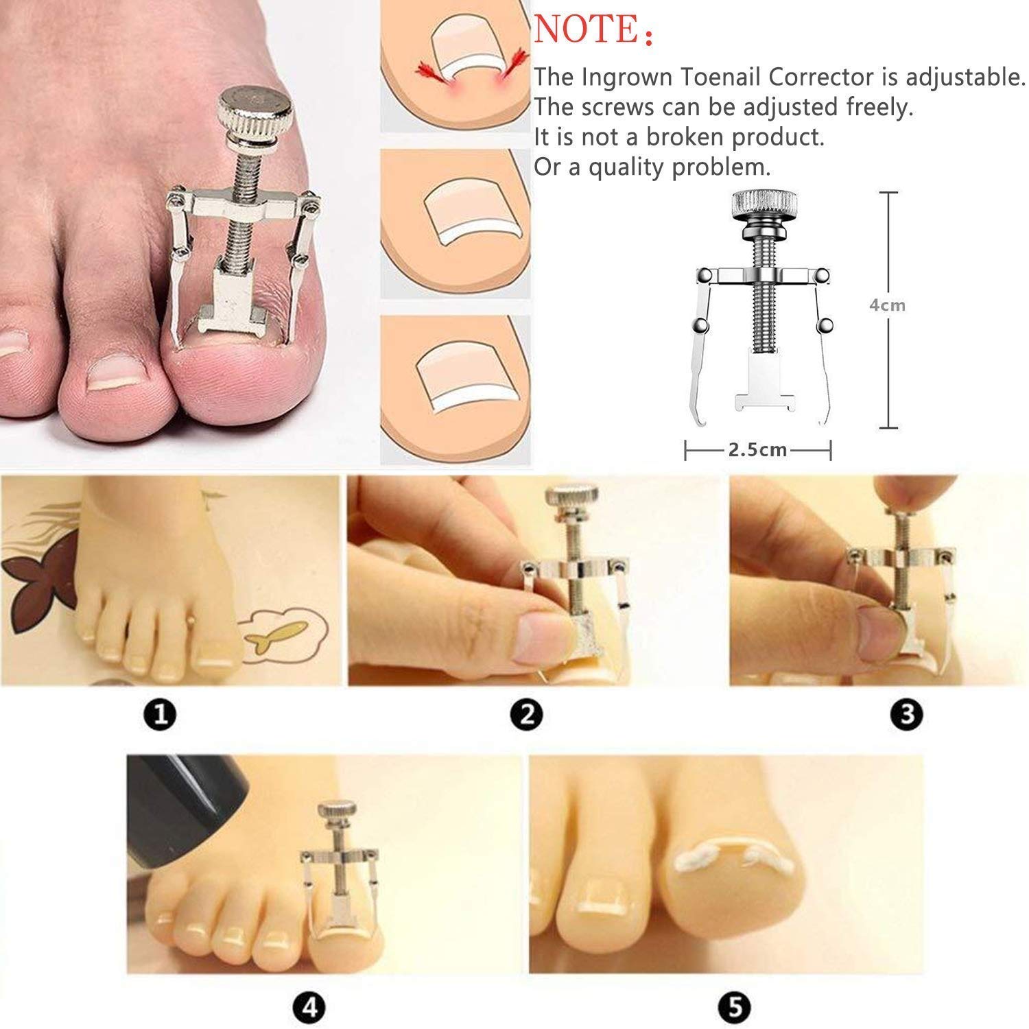 11Pcs/Set Ingrown Toenail Tools Kit Nail Care Pedicure Tools