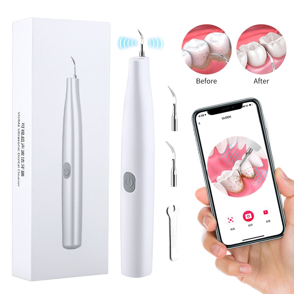 Ultrasonic Visual Dental Cleaning Teeth Whitening Kit Tartar