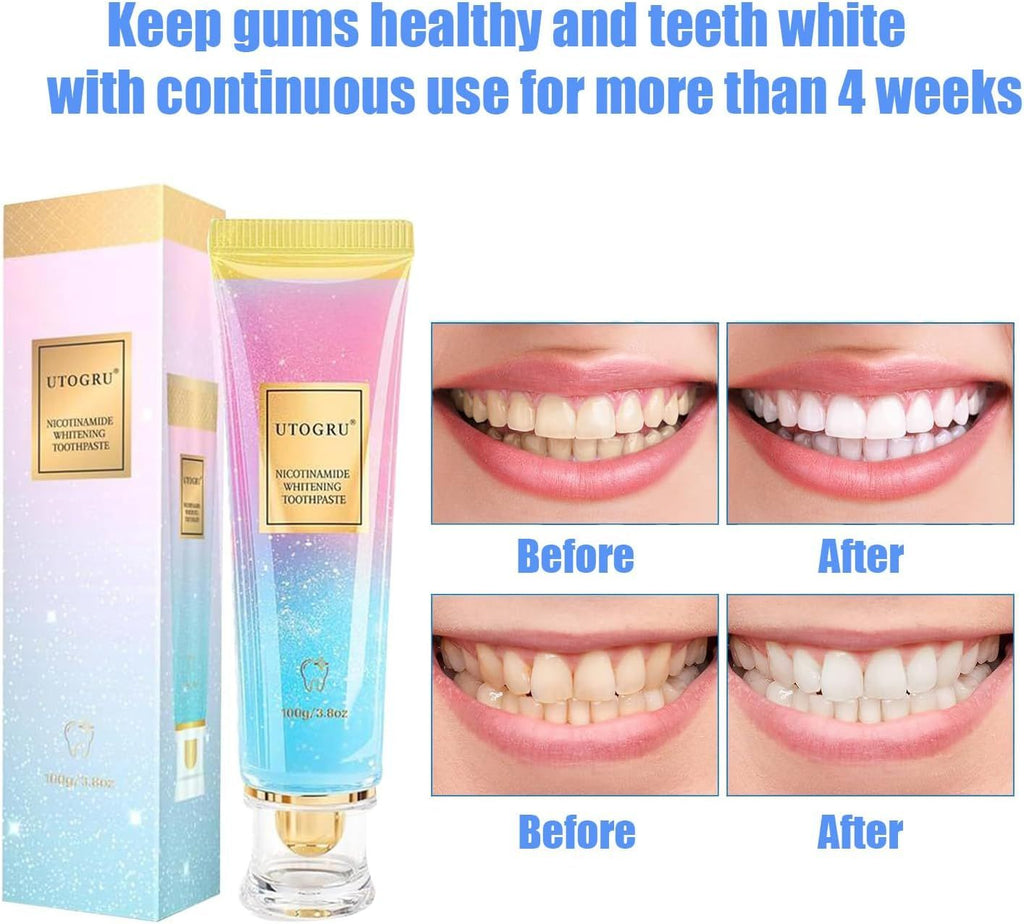 Niacinamide Whitening Toothpaste, Utogru Teeth Radiant Whitening