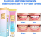 Niacinamide Whitening Toothpaste, Utogru Teeth Radiant Whitening