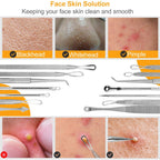 7 Pcs Blackhead Remover Kit Stainless Steel Pimple Comedone Acne